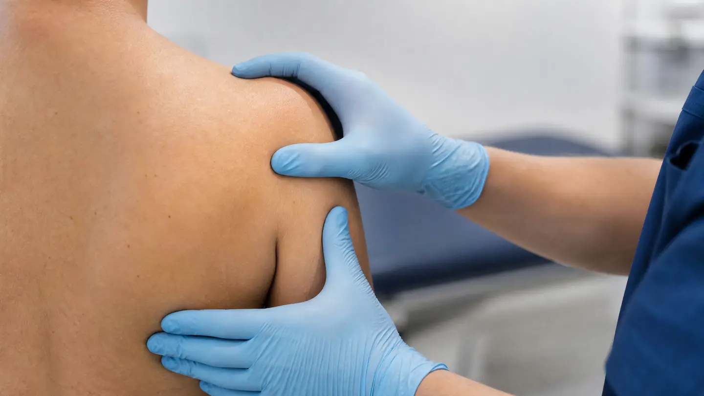 01 Shoulder Fracture 1