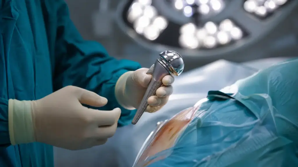 06 Shoulder Replacement 1