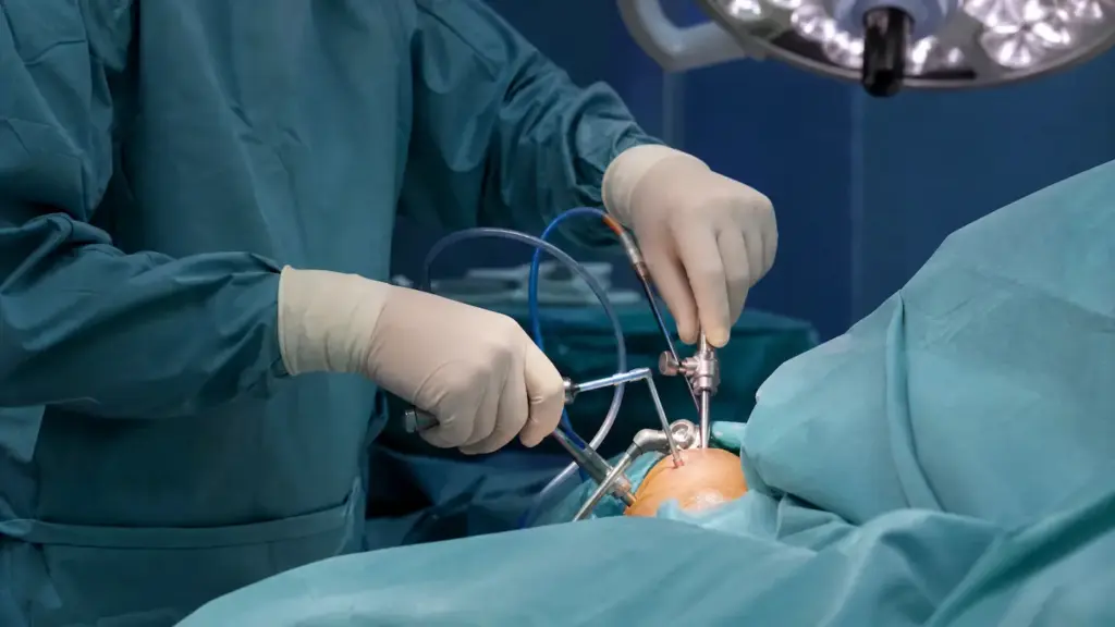 16 Latarjet Procedure 1