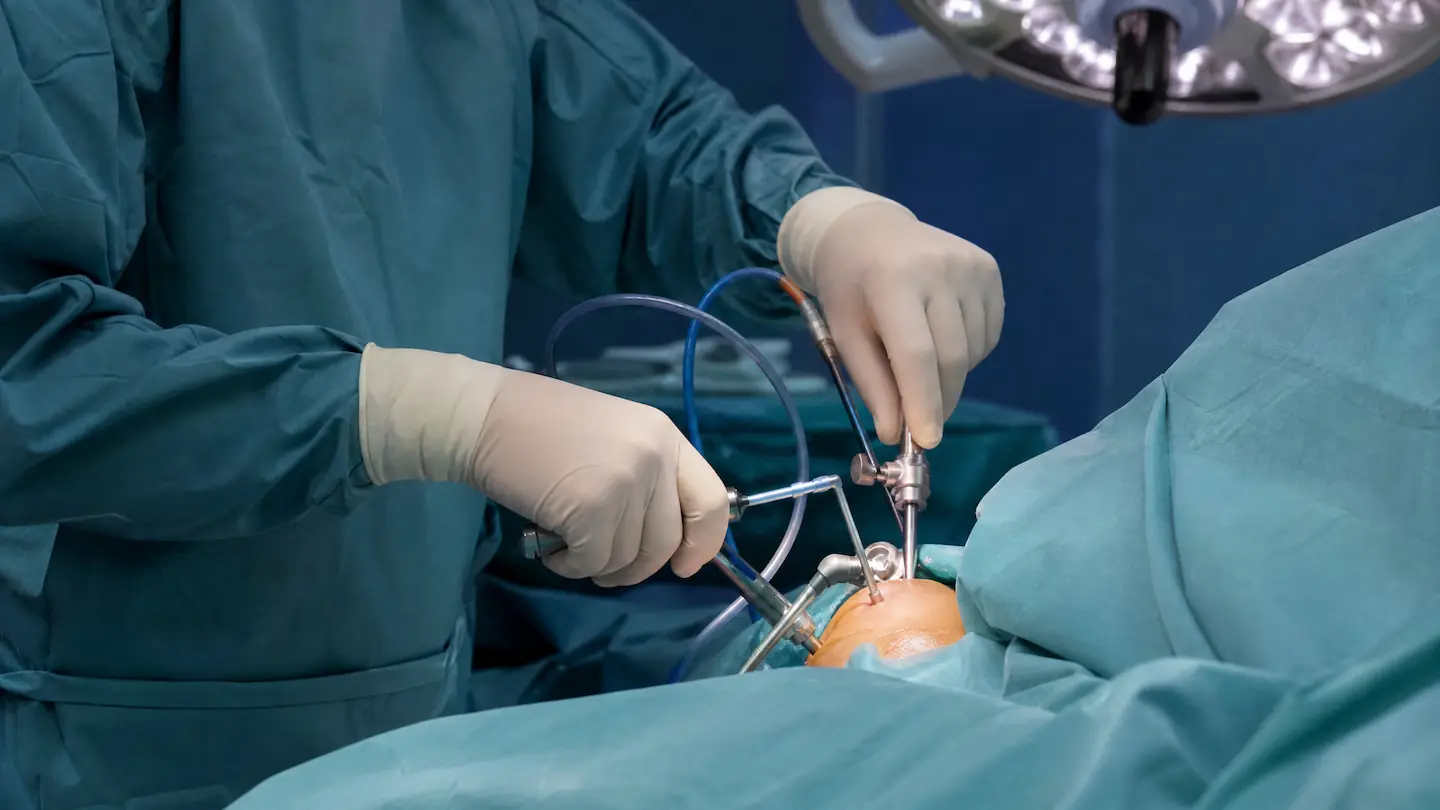 16 Latarjet Procedure 1