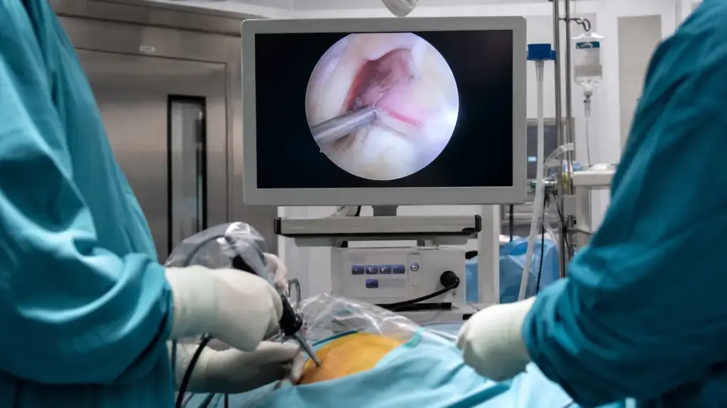 22 Labral Tear Arthroscopy 1